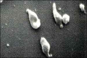 Mycoplasma genitalium: la bacteria con el genoma ms pequeo. (Foto: BBC)