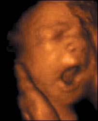 Las imágenes muestran que los fetos son mucho más activos de lo que se creía.