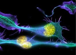 http://axxon.com.ar/noticias/imagenes/2014/0116-neuronas.jpg