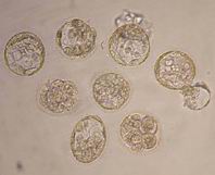Ocho embriones humanos clonados por los expertos de la Universidad Nacional
de Seul (Foto AP)